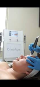 huidverbetering_antiage_rimpels_delft_hydradermabrasie_microneedling