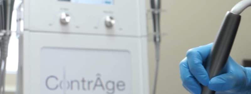 huidverbetering_antiage_rimpels_delft_hydradermabrasie_microneedling